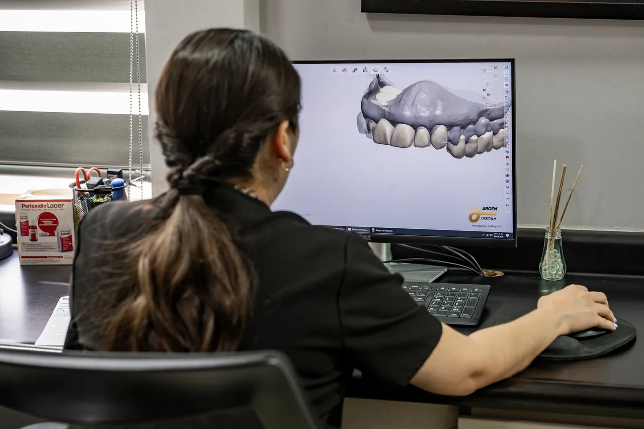 Diseño de una prótesis dental en software CAD