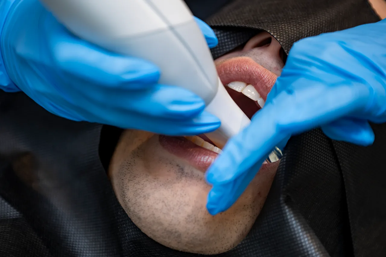 Escáner intraoral en la boca de un paciente, detalle
