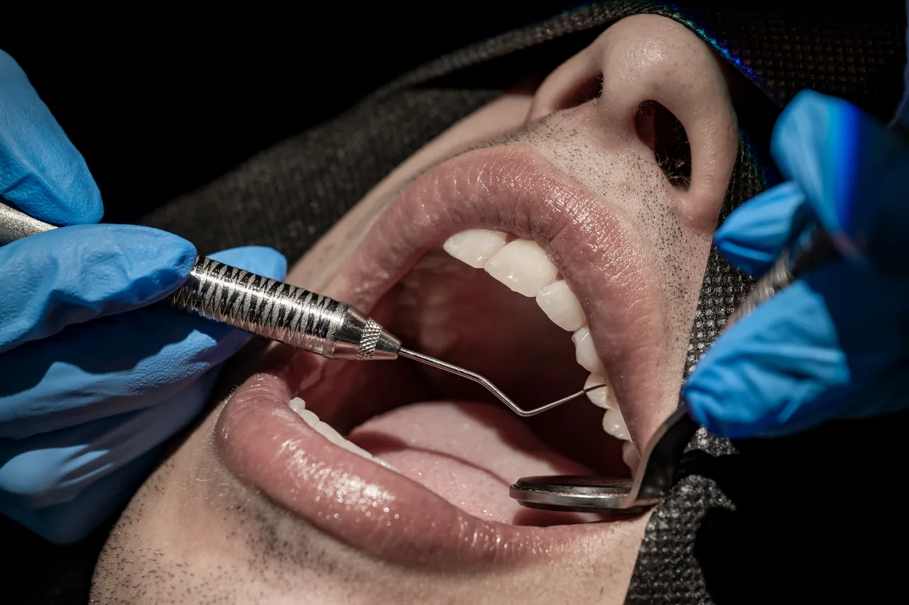 Revisión de la boca de un paciente con espejo dental en un consultorio de Klida
