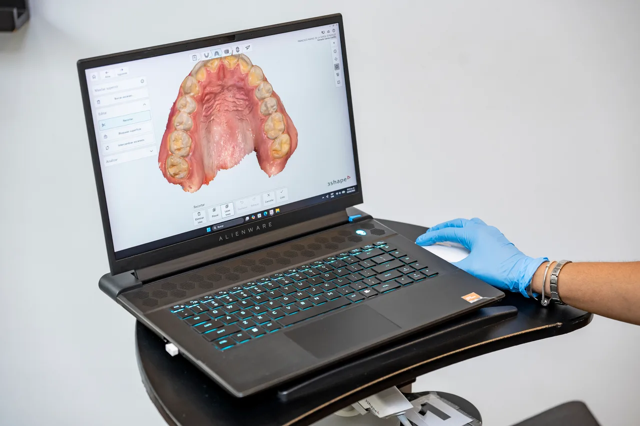 Modelo digital de una arcada dental en la pantalla de una laptop