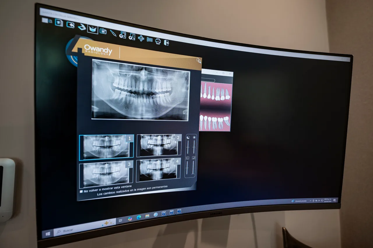 Radiografía panorámica y cortes de tomografía en el monitor de la clínica