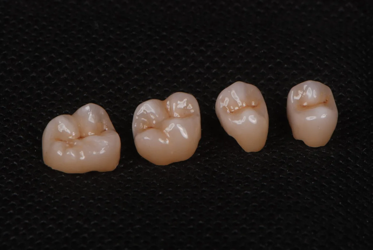 Cuatro coronas de zirconia para molares