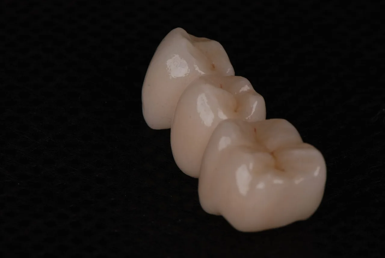 Puente de zirconia de tres piezas sobre fondo negro